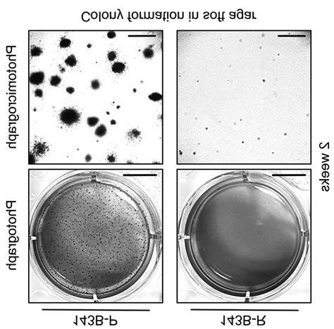 self-renewal test growth in soft agar|Analysis of clonogenic growth in vitro .